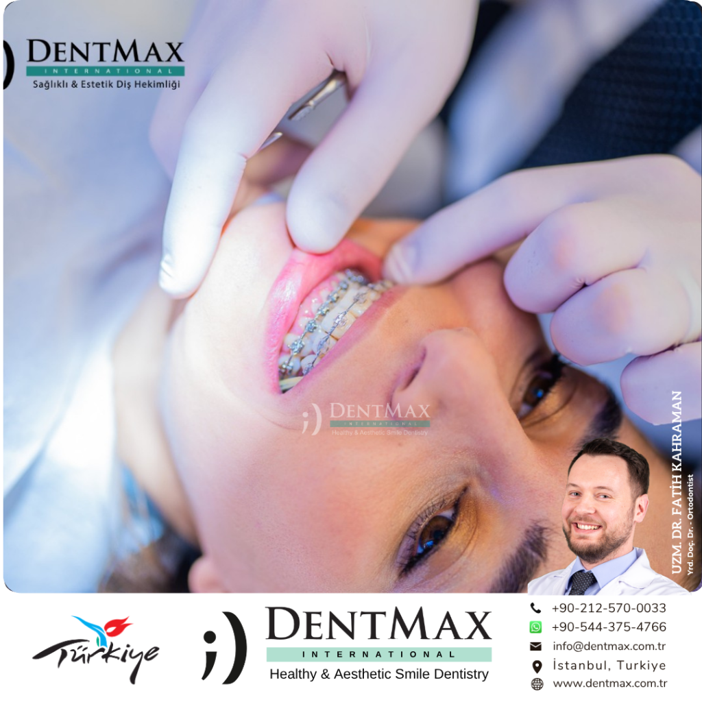 yetişkin ortodontisi istanbul bakırköy balıkesir invisalign diş teli erişkin ortodonti dentmax