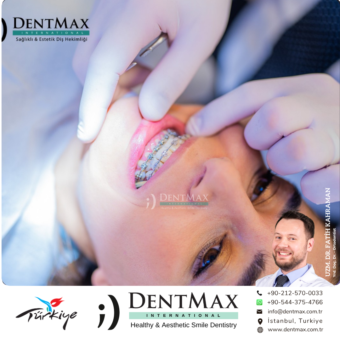 yetişkin ortodontisi istanbul bakırköy balıkesir invisalign diş teli erişkin ortodonti dentmax