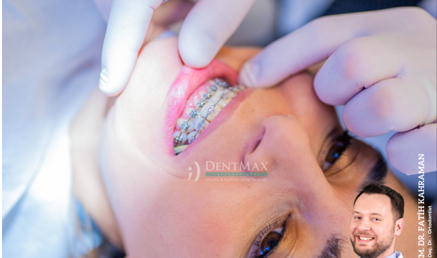yetişkin ortodontisi istanbul bakırköy balıkesir invisalign diş teli erişkin ortodonti dentmax