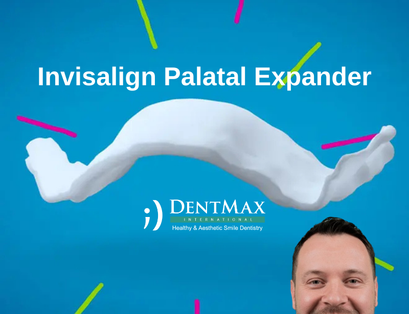 Invisalign Palatal Expander - Şeffaf Plak ile Çene Darlığı Tedavisi